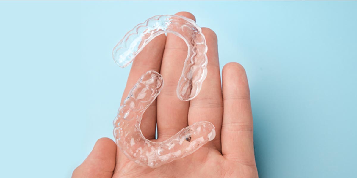 Aligners Pros and Cons