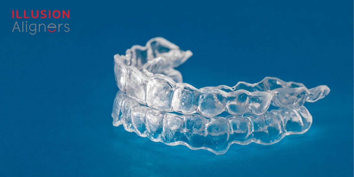 Why Illusion Aligners Are The Best Fit If You\'re Looking For Clear Aligners