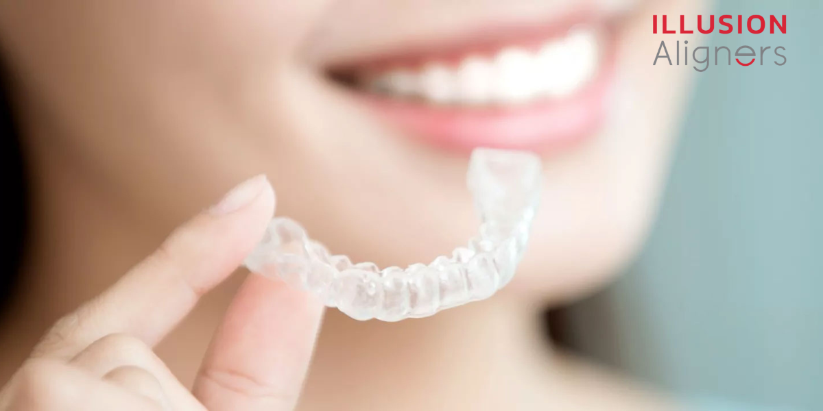 Teeth Growing in Your Gums - Can an Aligner Fix Hyperdontia