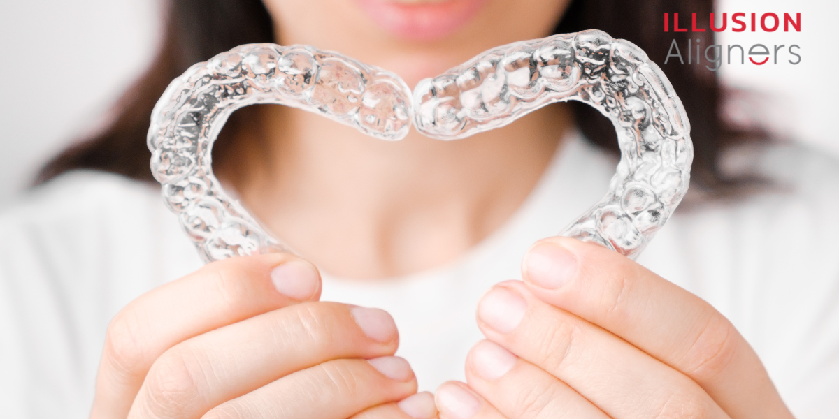 Learn About The Benefits Of Using Clear Aligners
